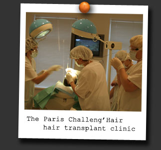 The Paris Challeng�Hair hair transplant clinic